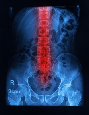 How Does a Spinal Injury Affect Sexual Performance?