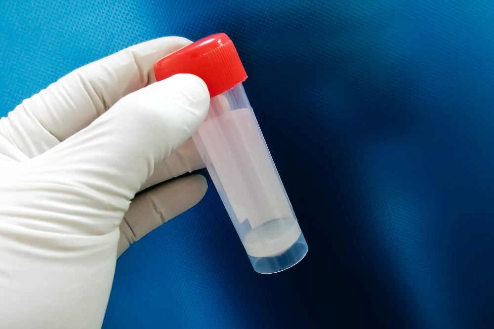 Overcoming No Sperm Count: Fertility Treatments for Men with Azoospermia