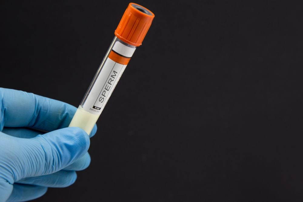 Post Mortem Sperm Retrieval & Sperm Freezing